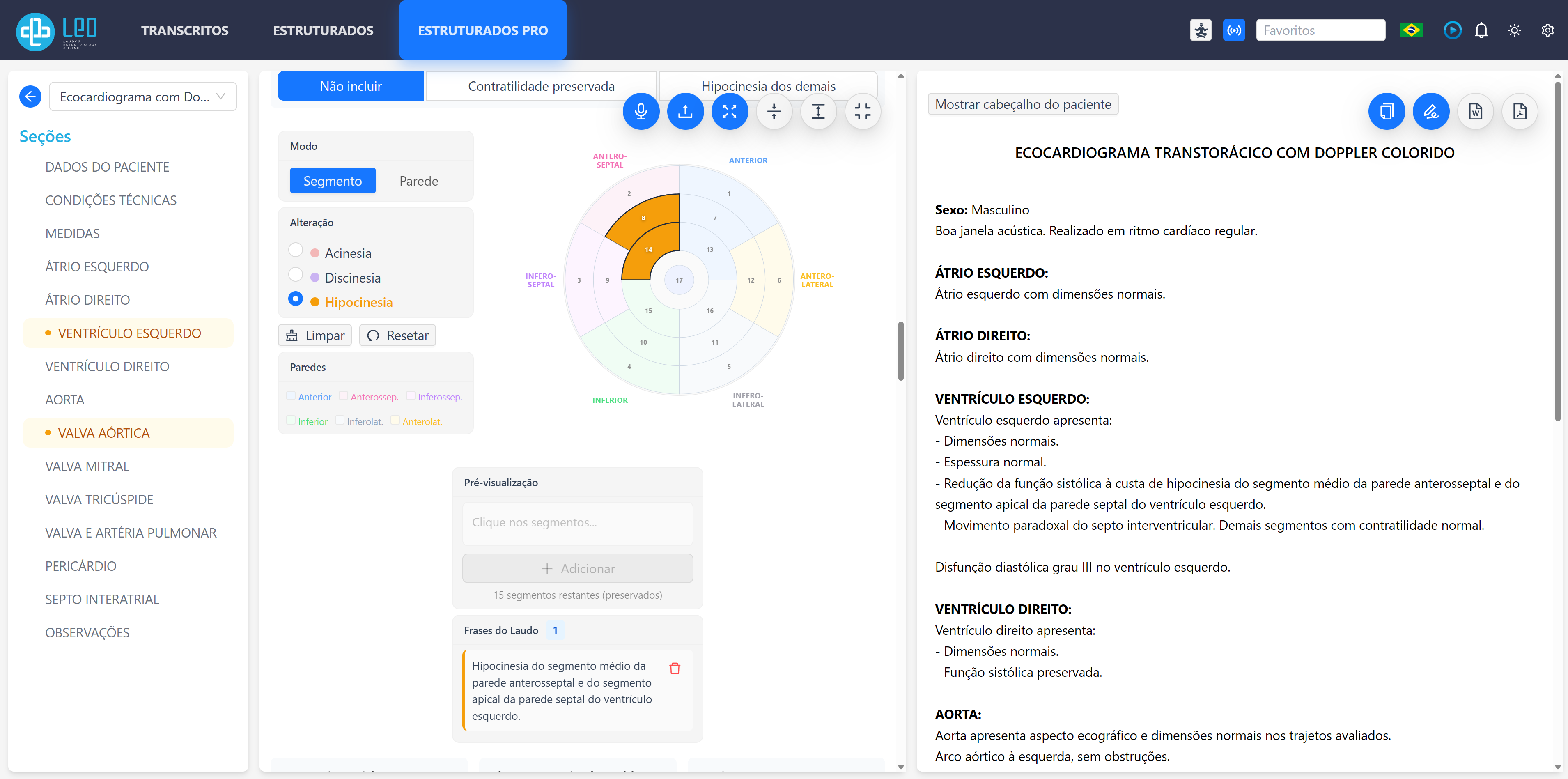 Tela da plataforma LeoRad mostrando modelo Estruturados Pro de Ecocardiograma Transtorácico com Doppler Colorido: diagrama radial de segmentação ventricular, classificação de hipocinesias e laudo final